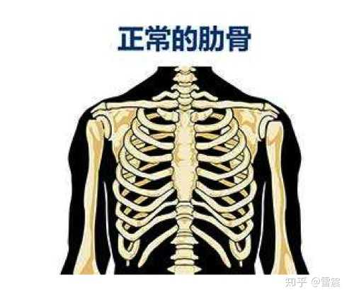 12肋称为"浮肋" 仰卧时最下端的肋骨超出身体平面,就会称之为肋骨外翻
