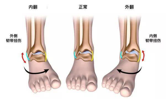 是胫骨与腓骨连接的地方 这个地方形成了瘤状的隆起 这两块骨头是由