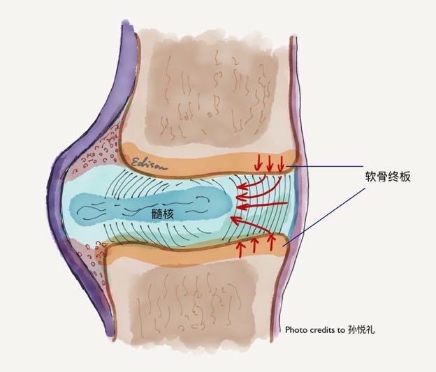 在「椎间盘森林」和「椎体古堡」的边界上,有一道「软骨终板收费站」.