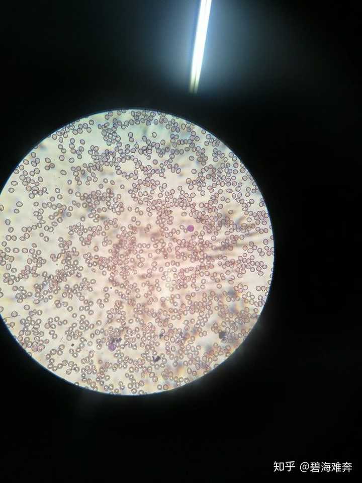 舍友的红细胞白细胞和血小板