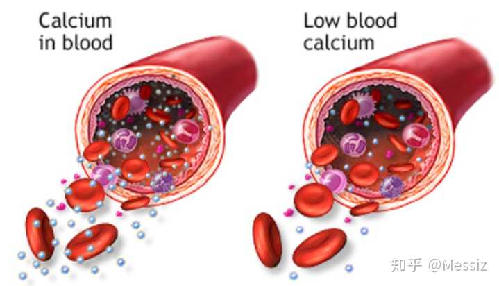 左-正常血钙 右-血钙低于正常量
