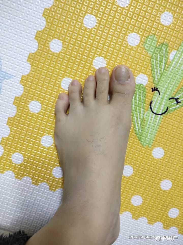 女生脚丑是种什么样的体验?