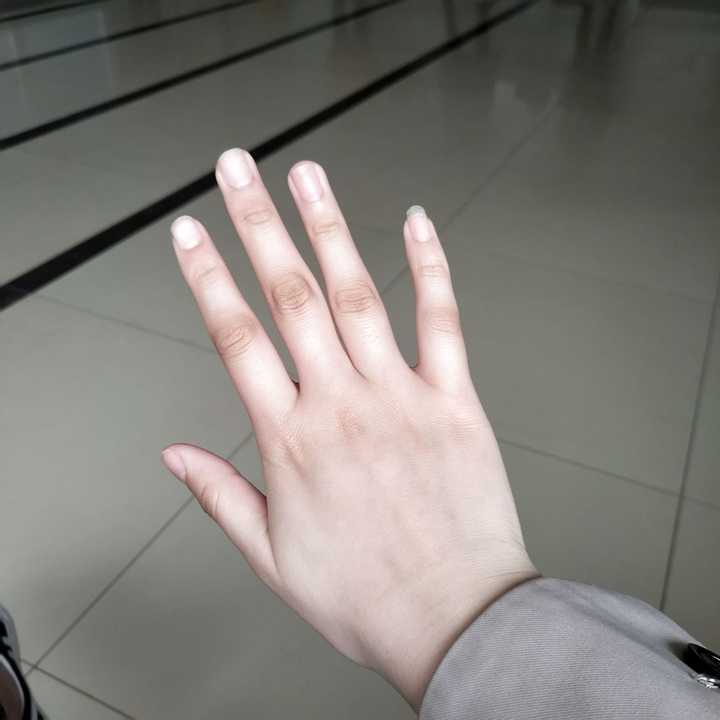 女生手指关节发黑何解决?