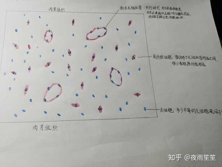 肉芽组织和血栓的红蓝铅笔手绘图怎么画?救救孩子吧!