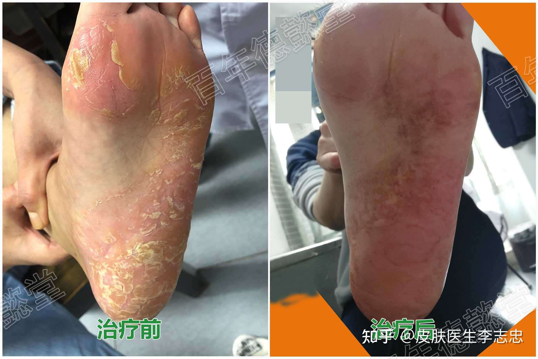 皮肤医生李志忠