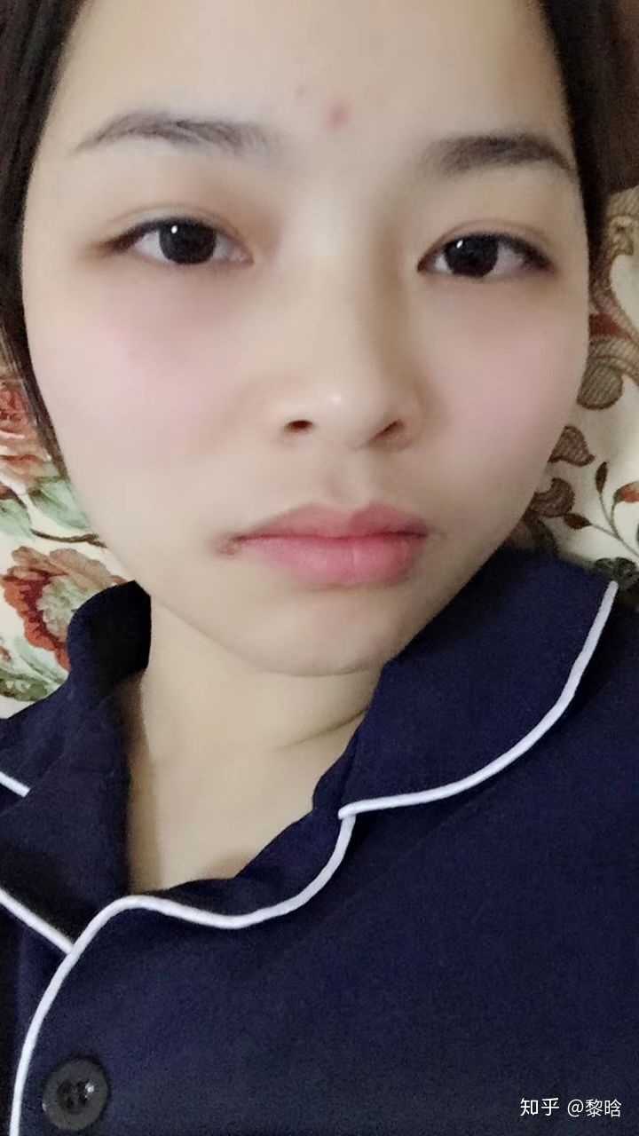 现在素颜眼睛看起来也比较自然了