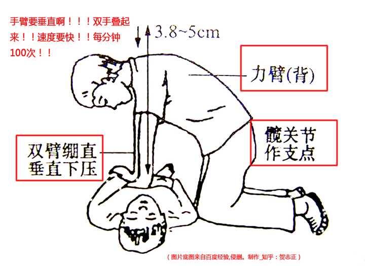 对溺水的人进行心肺复苏前不需要排水吗?万一人工呼吸