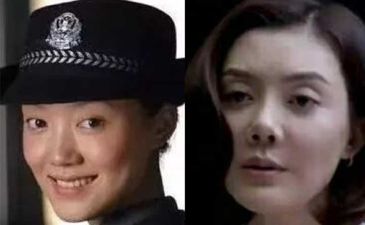 比如沈梦辰,车晓的"朝天鼻" l型假体产生包膜挛缩,鼻子张力不够,导致