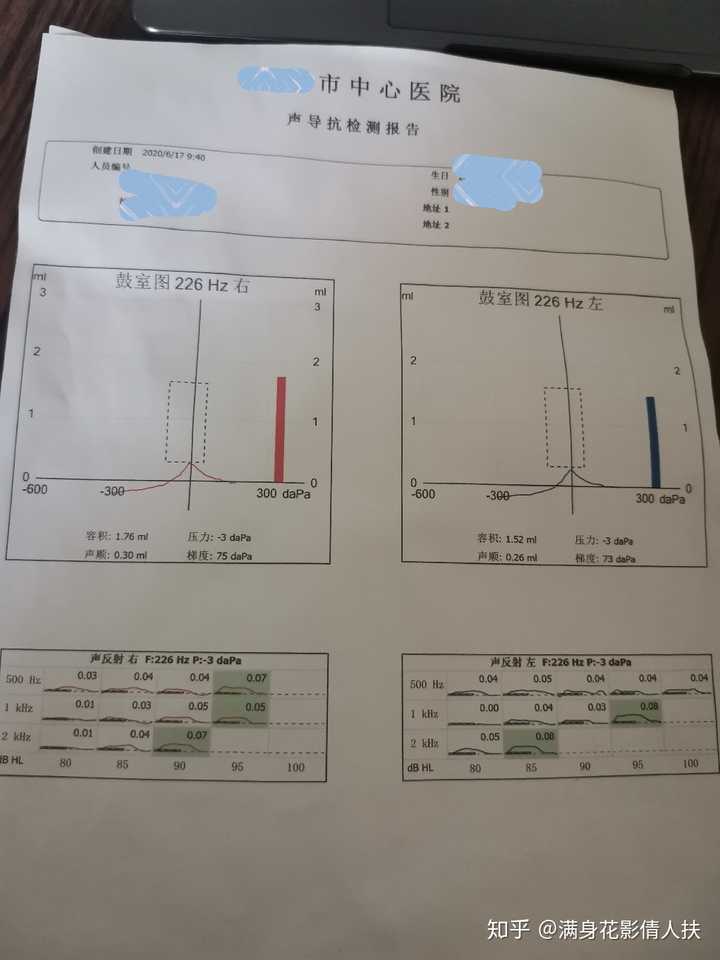 3-声导抗检测报告(啥也看不懂)