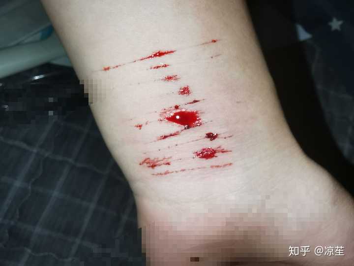 怎样看待自残的女孩?