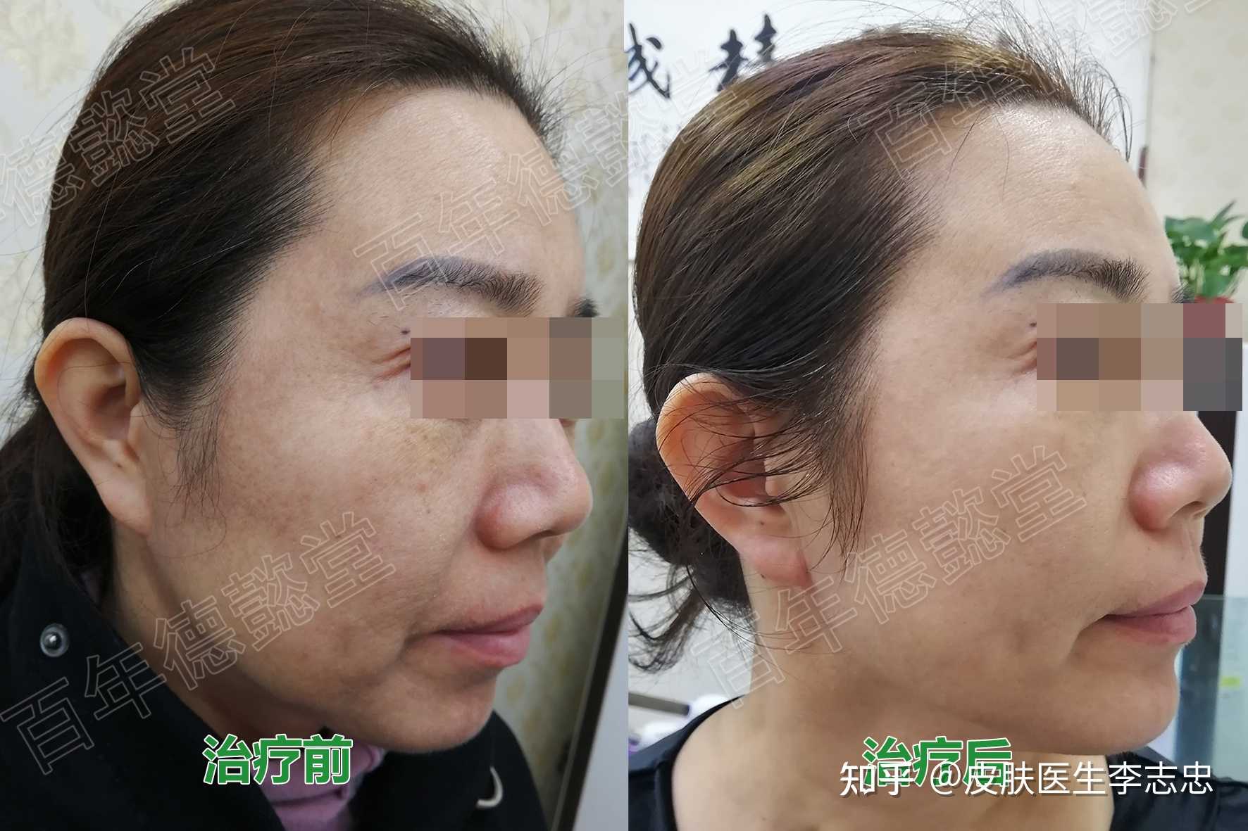 皮肤医生李志忠