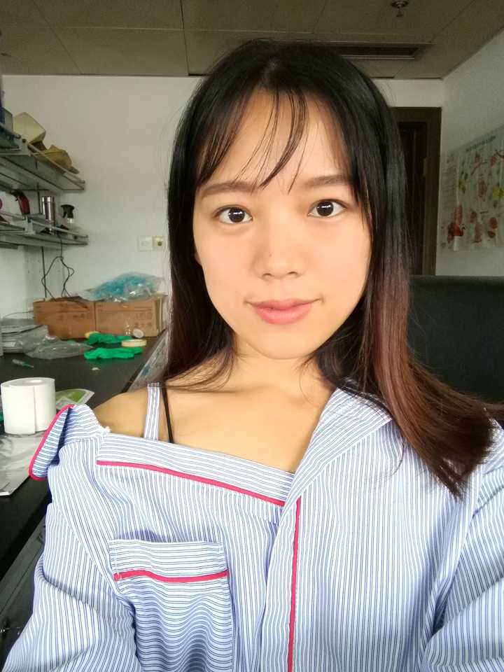 割双眼皮不开眼角三个月了眼皮上缝线的地方有凹点还能恢复平吗