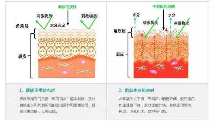 过敏性肌肤和对花粉过敏应该用什么护肤品?