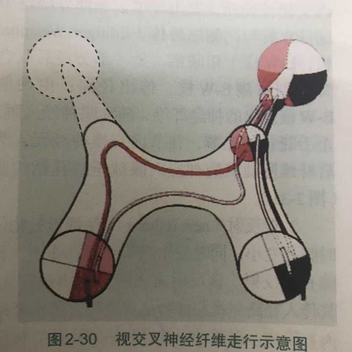组成包括六部分,视神经,视交叉,视束,外侧膝状体,视放射,视皮层.