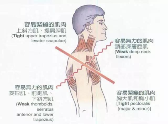 放松过度拉伸/僵硬的肌肉的重要性