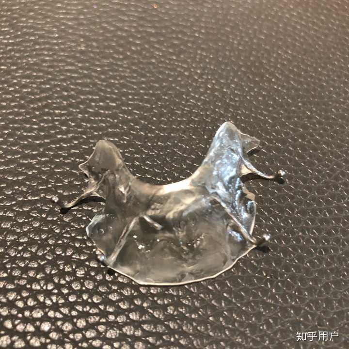 牙齿正畸戴平导的体验