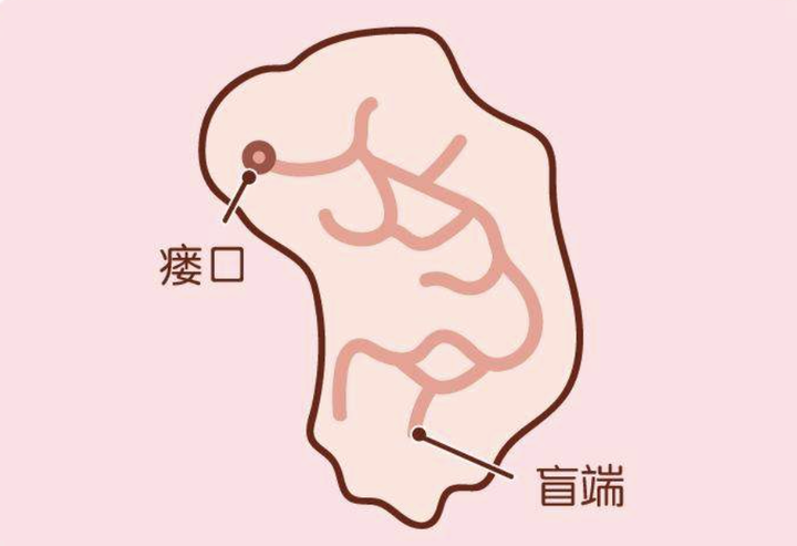 耳仓里面就好比迷宫,瘘管深浅长短不一,有的里面却四通八达,甚至能通
