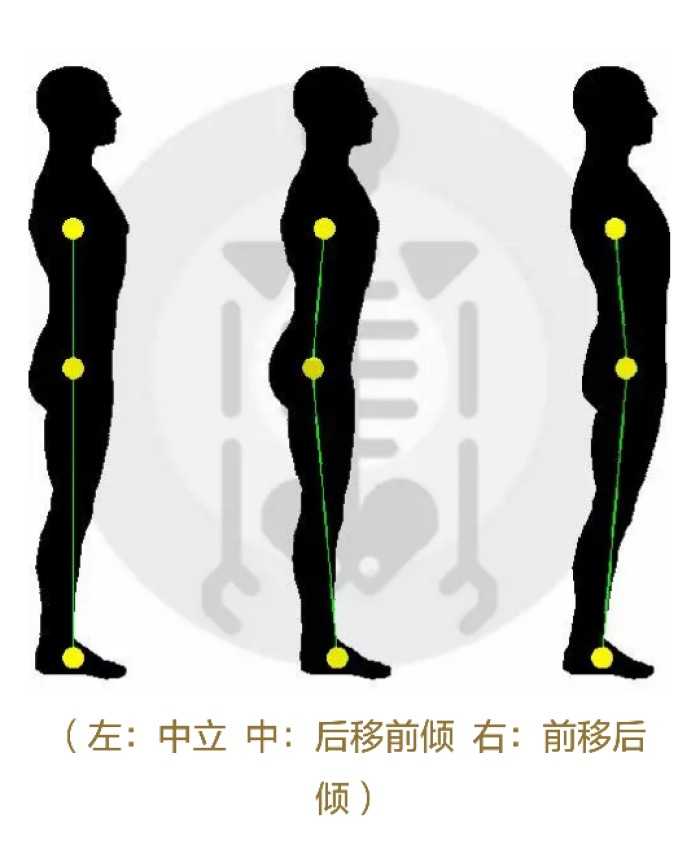 (此图来自网络截图) 正常的体态,与盆骨前倾,盆骨后倾的区别.