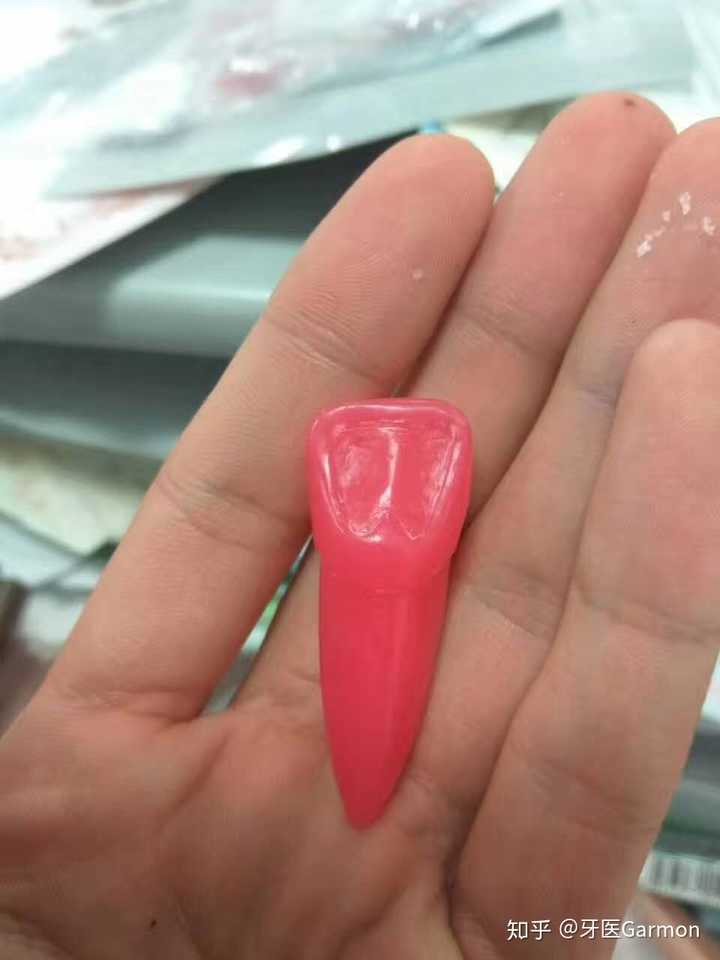 就是用一块蜡块,雕刻成一颗牙齿的形状.
