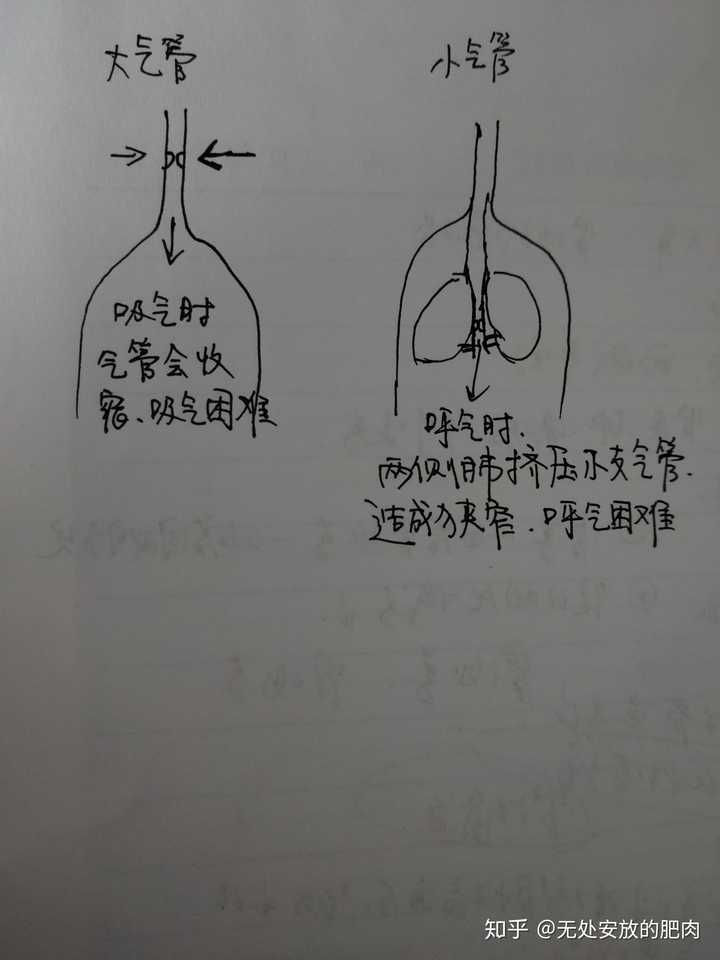 大支气管为什么造成吸气性呼吸困难?