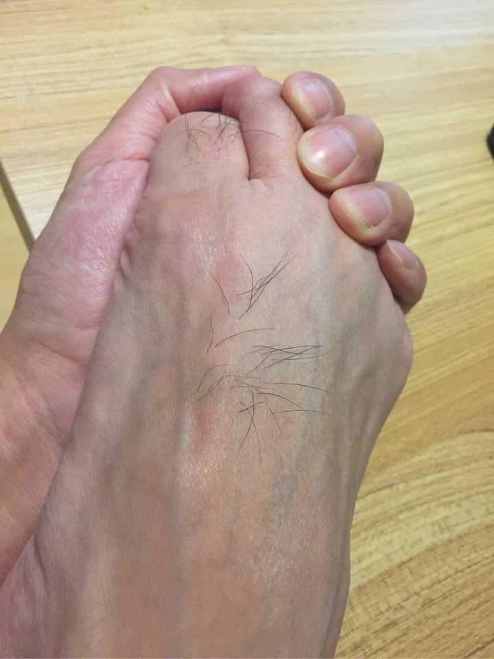 为什么脚背上不会长汗毛?