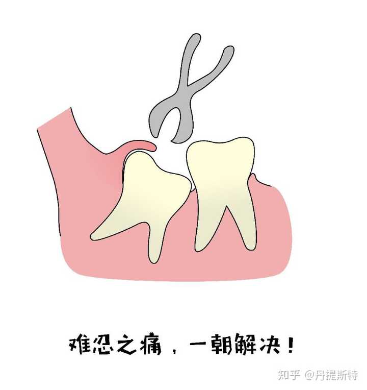 拔完智齿一定会脸肿吗