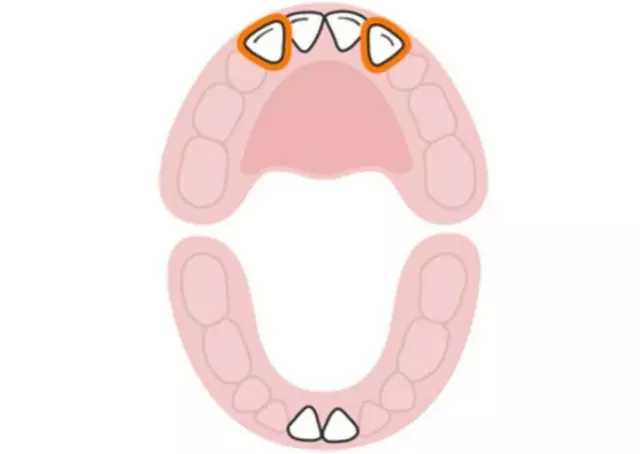 宝宝长牙顺序图&宝宝换牙顺序图?