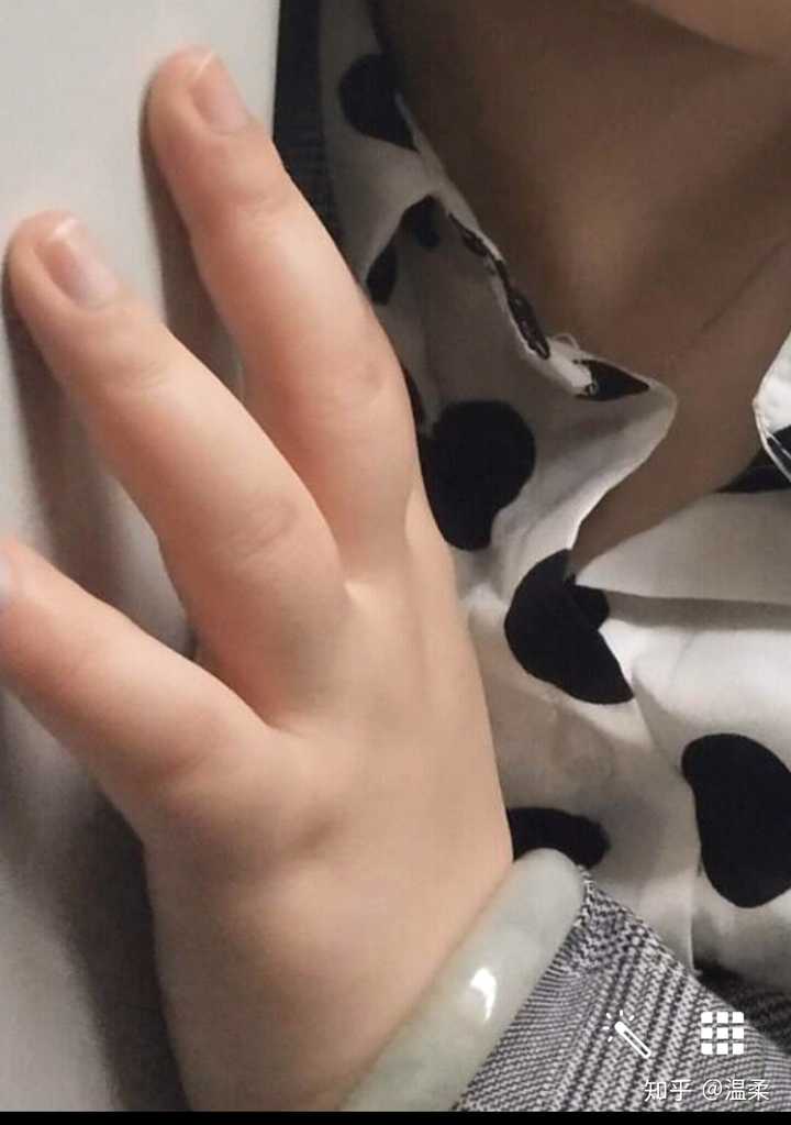 手胖是一种怎样的体验?