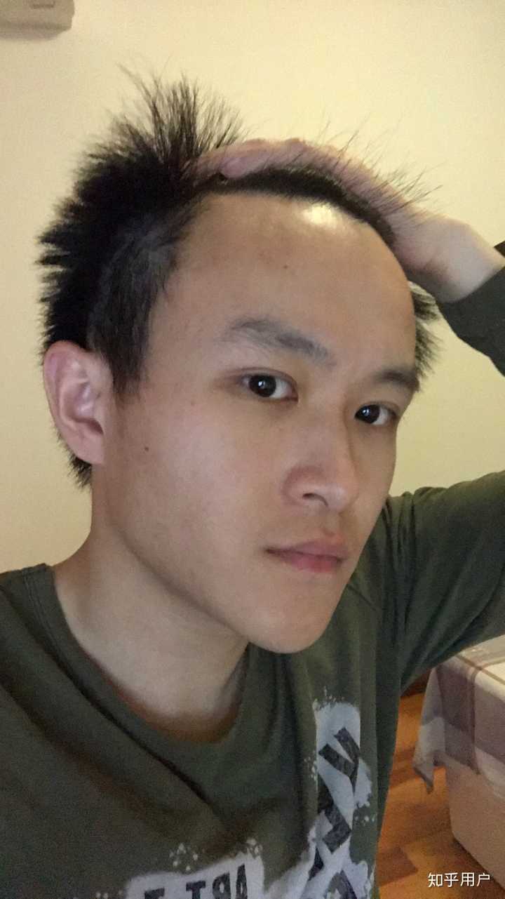 脑门大是怎样一种体验?