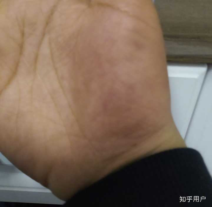 有没有被老师打手心的经历?