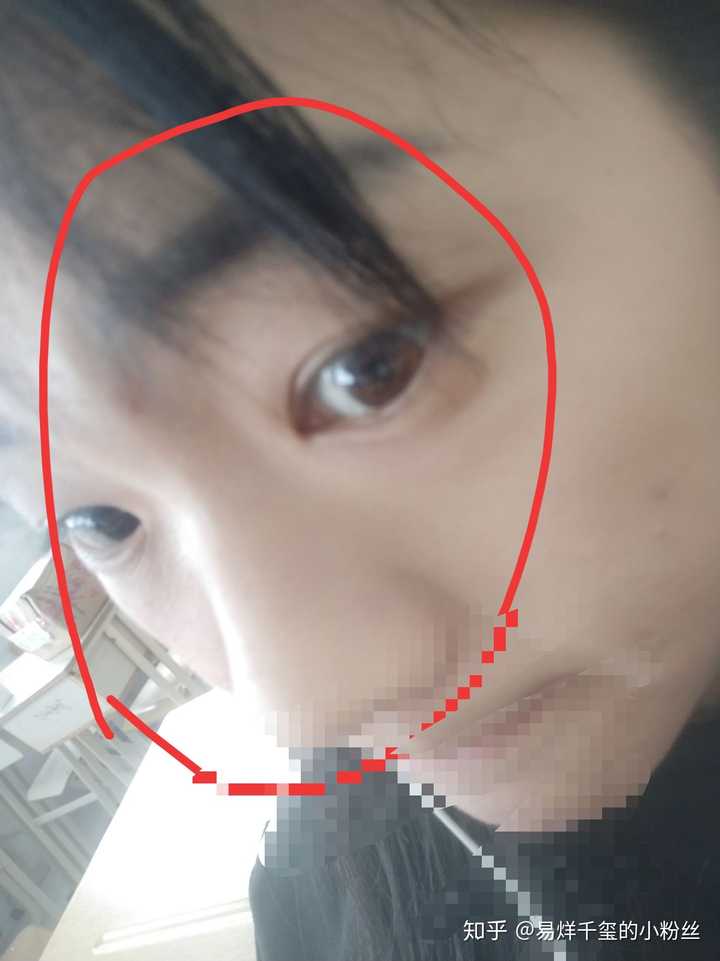 的山根部分我给圈出来了 就很特意的去拍侧面都显不出来我的鼻子呀,太
