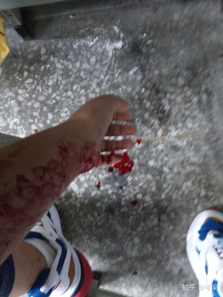 自残属于什么心理?