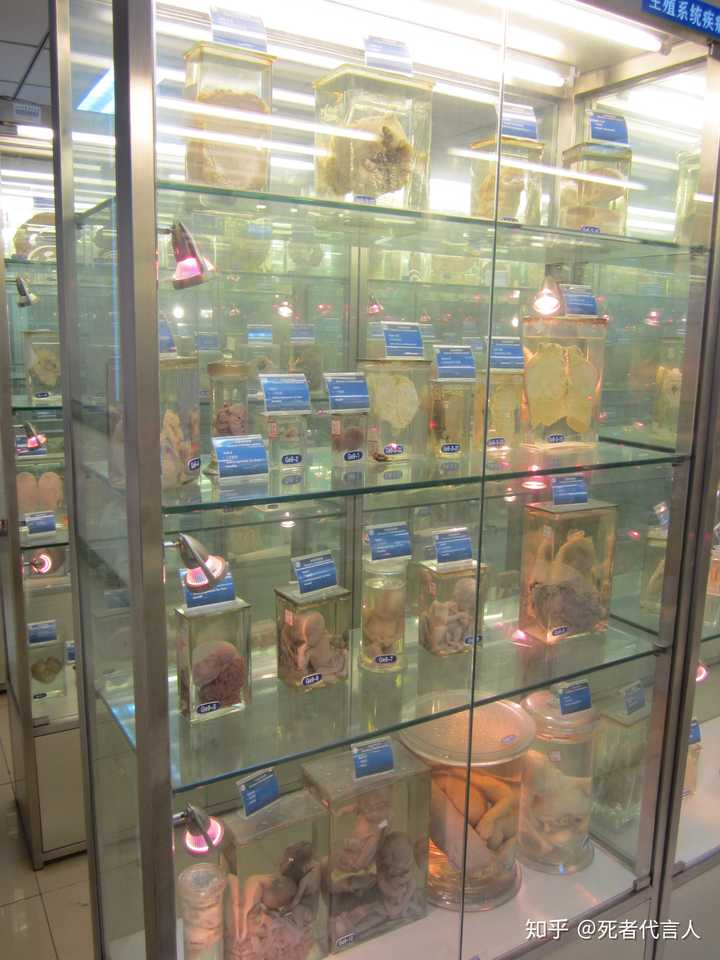 一些学校用玻璃容易装着的器官标本,实际也是浸泡在福尔马林溶液中的