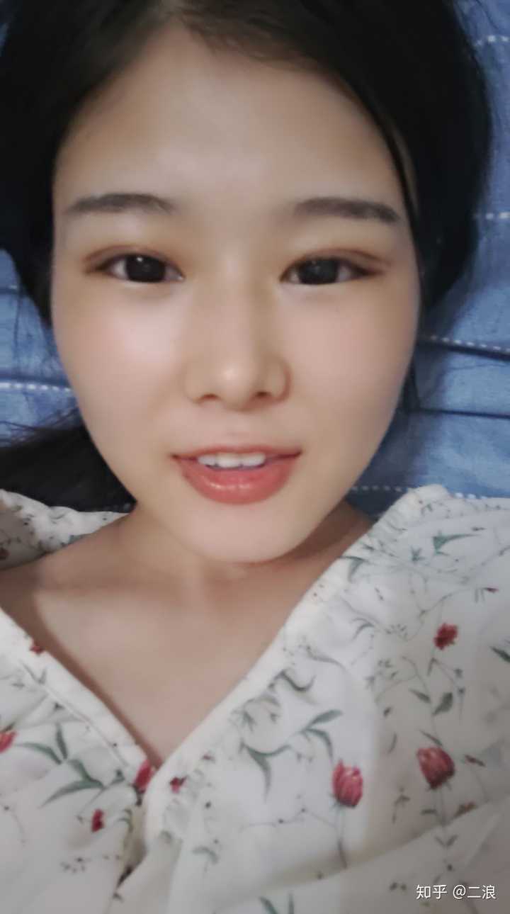 割双眼皮是种怎样的体验