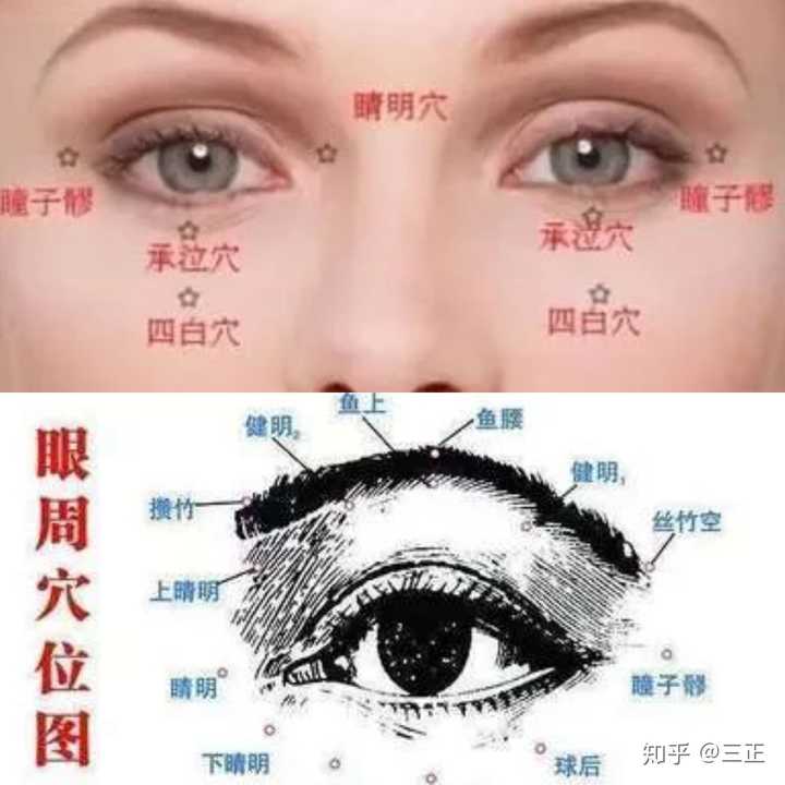 用无名指按压瞳子髎(在眼尾处),球后(下眼眶中外1/3处),四白(下眼眶