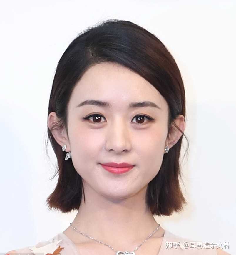 耳朵小双耳贴脑怎么改善63