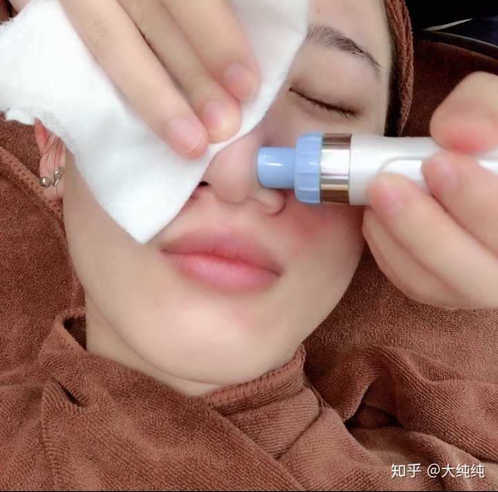 有哪些去黑头产品比较管用?推荐理由是什么?