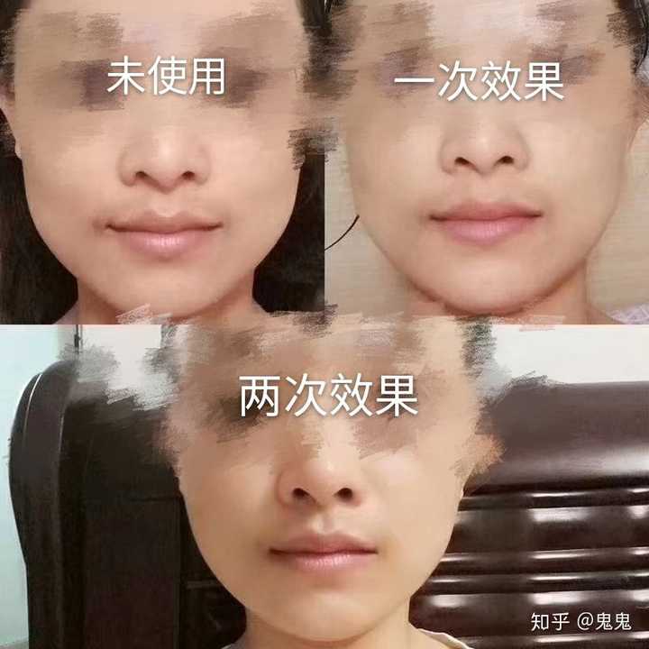 (不吃减肥药)尤其是脸,一个寒假过去,胖了不少?