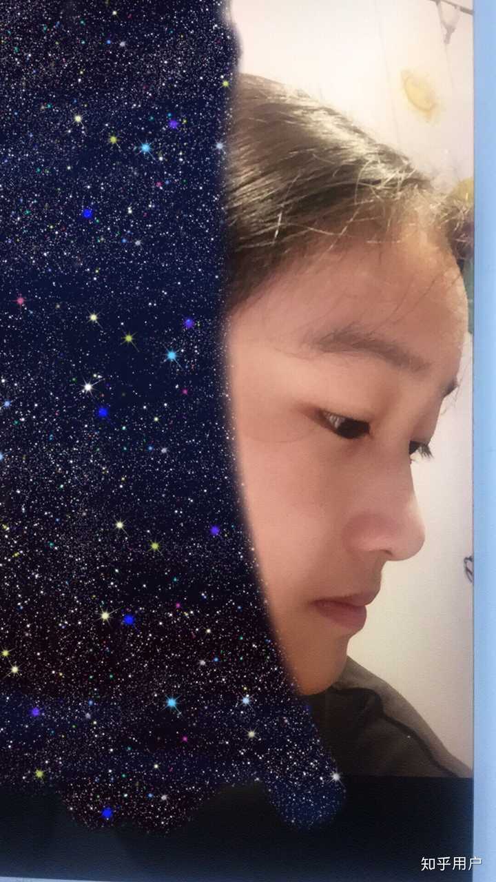 是我没错了 瘦的时候有鼻子,胖了脸肉多了鼻子就没了