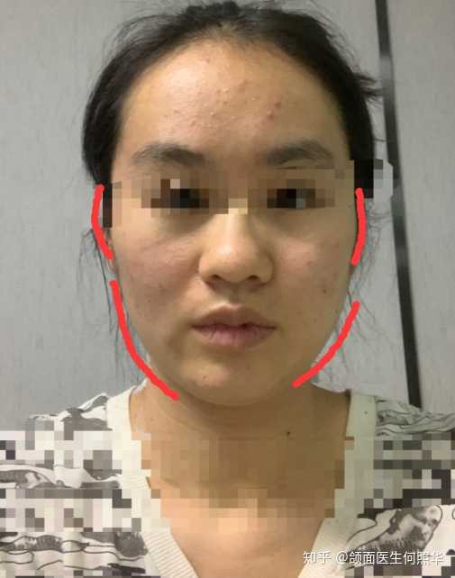 大小脸挂什么科 知乎