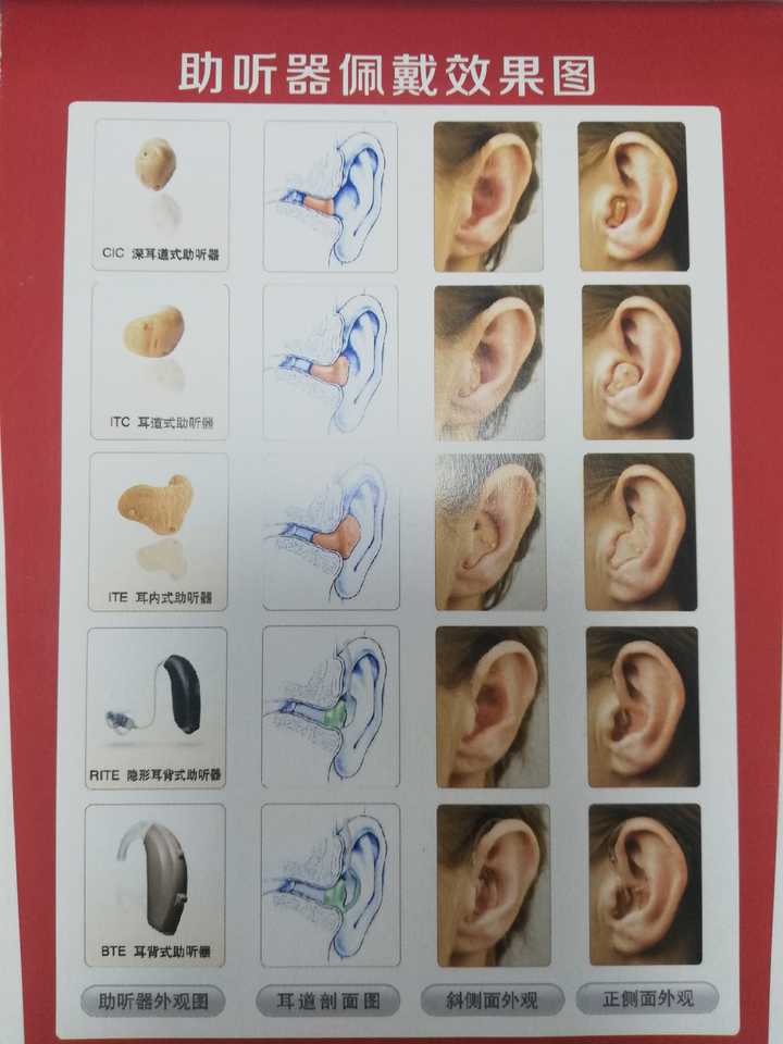 定制式: ite(耳内式助听器) itc(耳道式助听器) cic(深耳道式助听器)