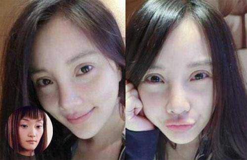 李小璐直播被网友评为网红整容脸,如何看待她现在的颜值相貌?