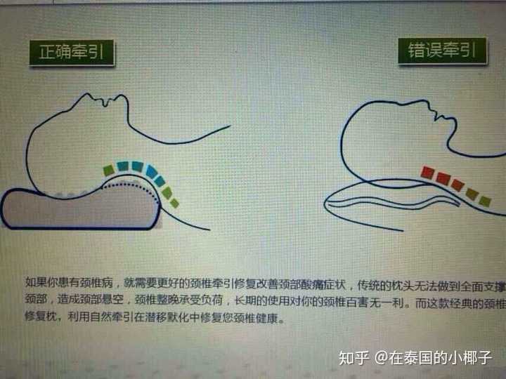 颈椎不好,想买一个好枕头,该如何选择?只能买乳胶枕头