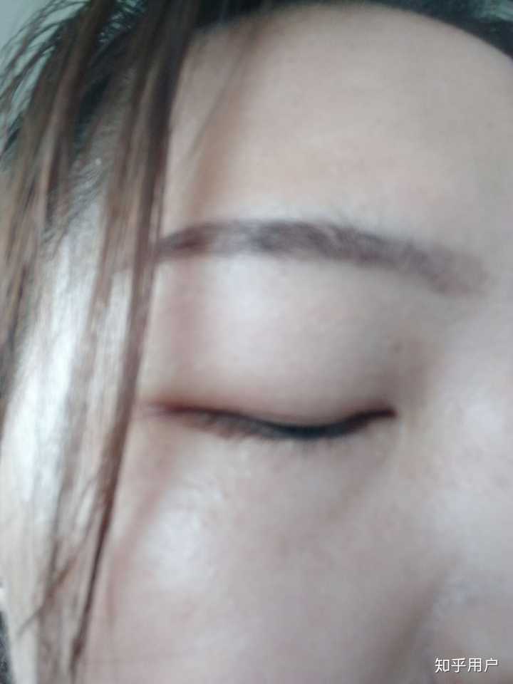 想操作你们肿方法的妹子有没有v方法的双眼皮贴?红米3手机截图怎么问问眼泡图片