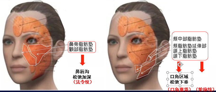 抗衰医生周业松 的想法 从解剖学来看,我们面部脂肪并不是均匀的