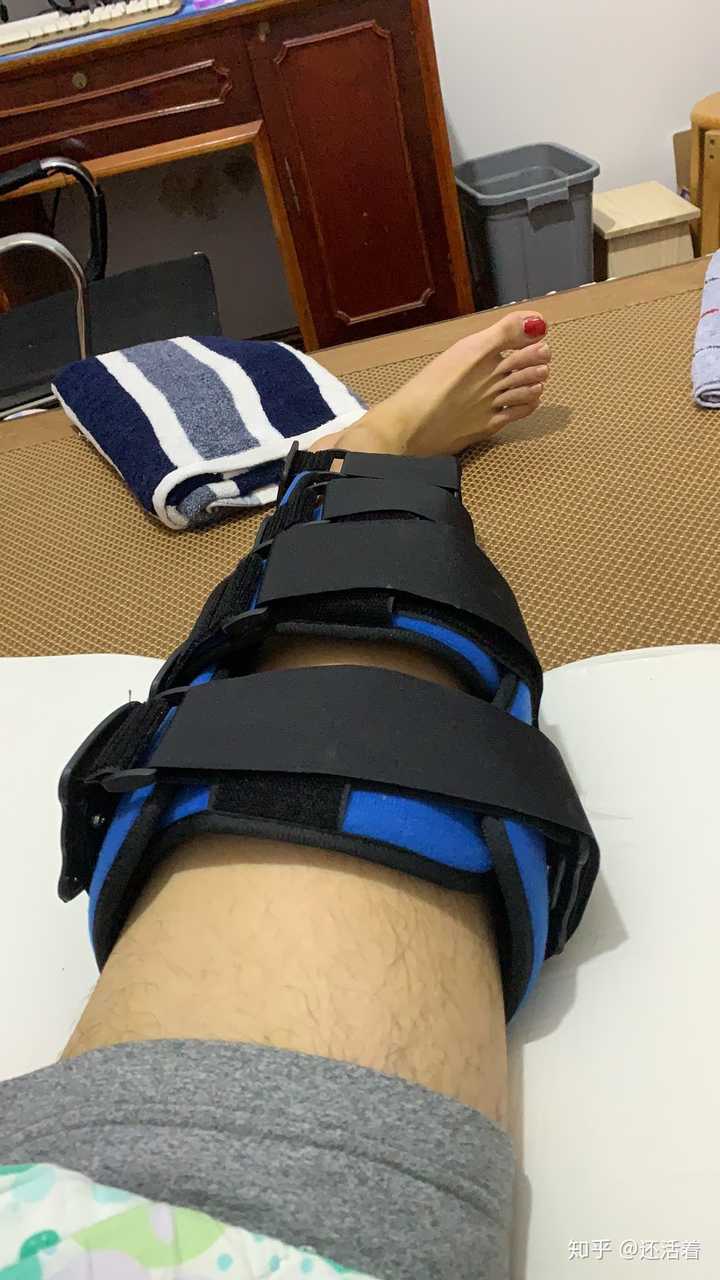 高中毕业打工期间下班打篮球,现在前交叉韧带断裂半月板损伤静养中