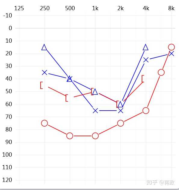有没有人可以帮我分析下如图的听力测试结果?配助听器得多钱价位的?