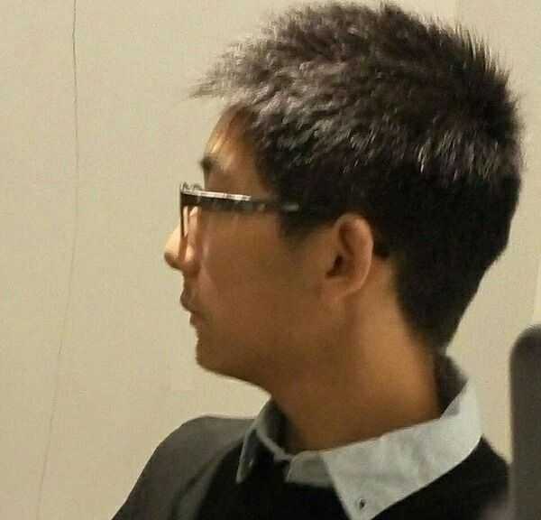 请问这样算是凸嘴吗,我觉得自己凸嘴并且下巴短,带牙套可以矫正吗?