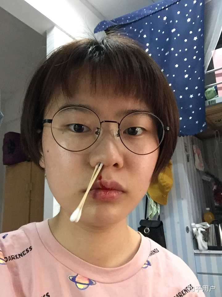 有没有人五官不好看 比如 小眼睛,单眼皮,塌鼻子,大鼻子,厚嘴唇 但拼