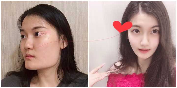 面部削骨能让一个人变化多大?www.zhihu.com回答